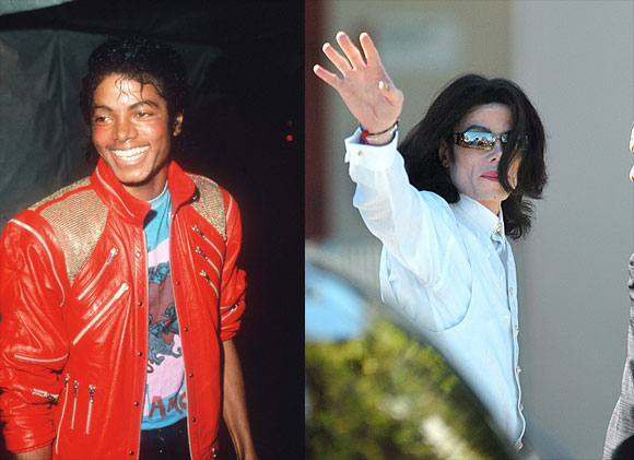 Michael Jackson neden öldü