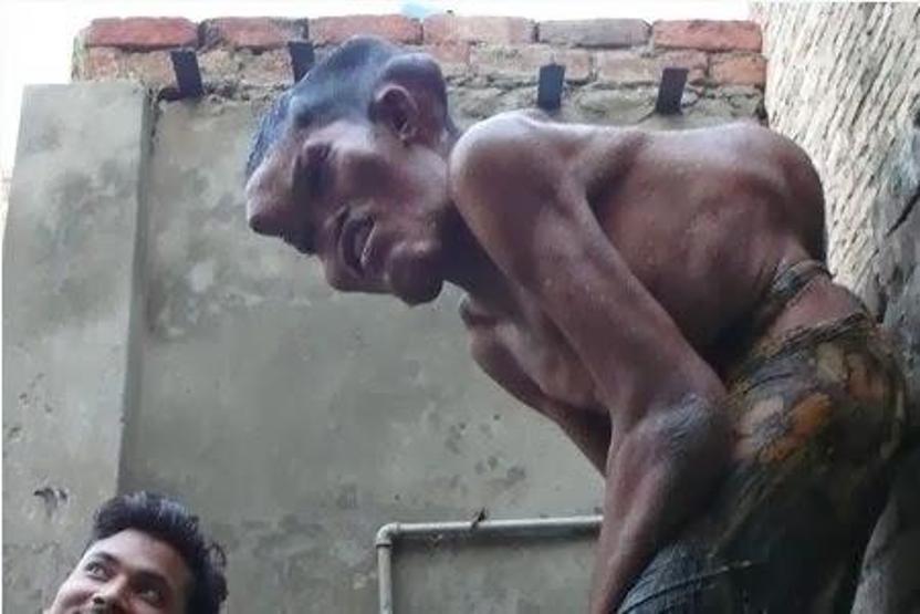 22 yıldır böyle yaşıyor