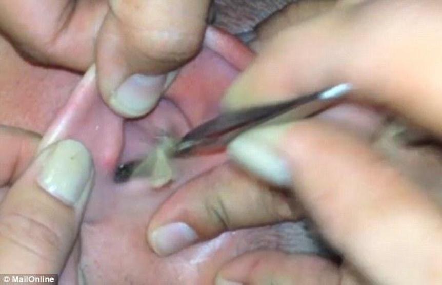Kulağından bunlar çıktı