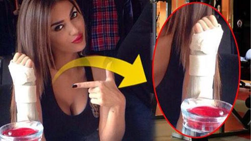 Yolanthe yenge elini kırdı