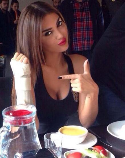 Yolanthe yenge elini kırdı
