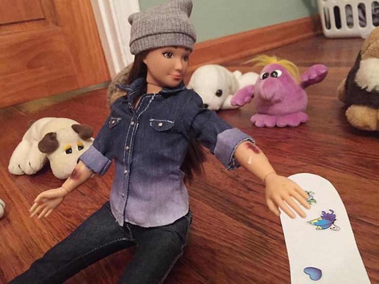 Sivilceli ve siğilli Barbie