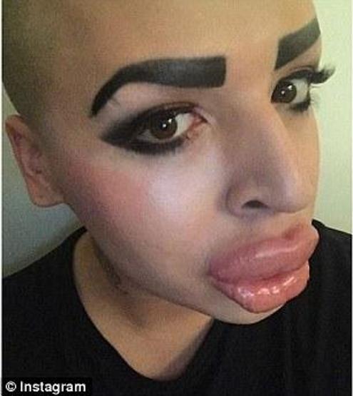 Kim Kardashiana benzemek istedi ama...