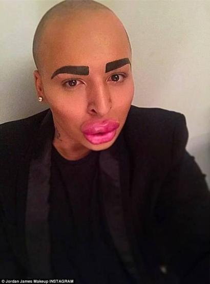 Kim Kardashiana benzemek istedi ama...