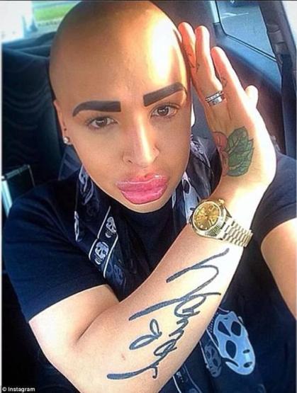 Kim Kardashiana benzemek istedi ama...