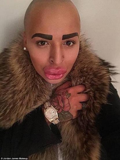 Kim Kardashiana benzemek istedi ama...