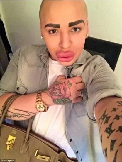 Kim Kardashiana benzemek istedi ama...