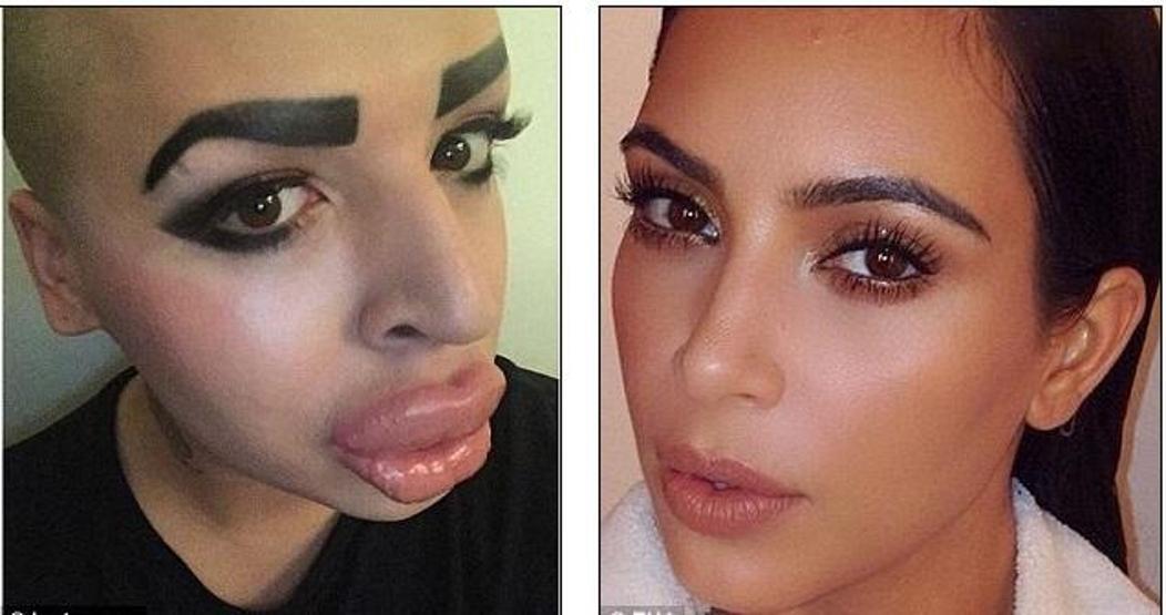 Kim Kardashiana benzemek istedi ama...