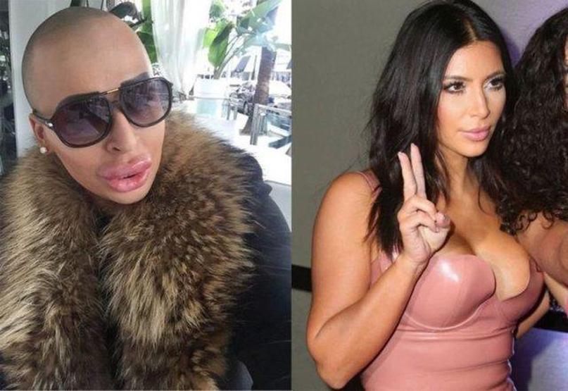 Kim Kardashiana benzemek istedi ama...