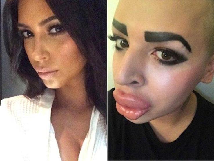 Kim Kardashiana benzemek istedi ama...