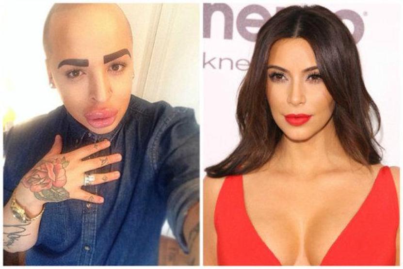 Kim Kardashiana benzemek istedi ama...