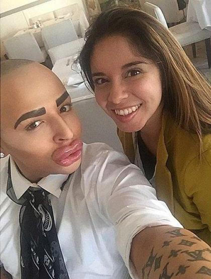 Kim Kardashiana benzemek istedi ama...