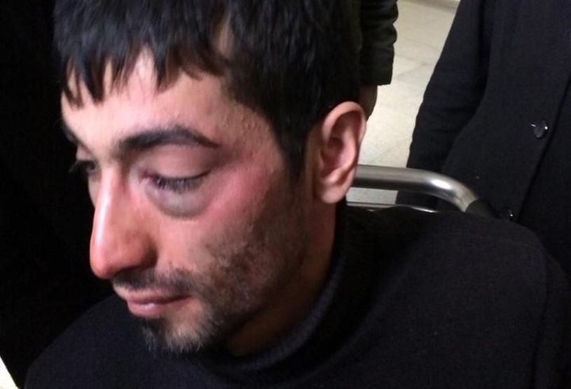 Tarihi geçmiş gaz bombası 4 kişiyi hastanelik etti