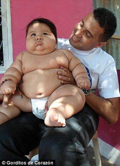 20 kiloluk bebek şaşırttı