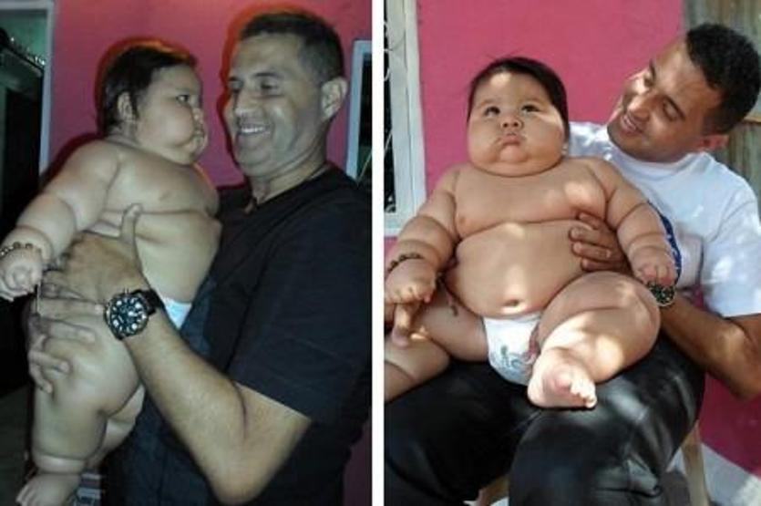 20 kiloluk bebek şaşırttı