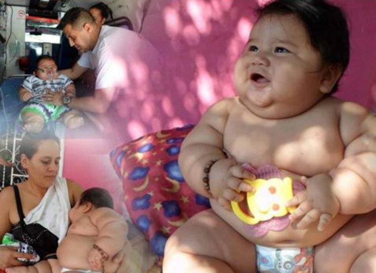 20 kiloluk bebek şaşırttı
