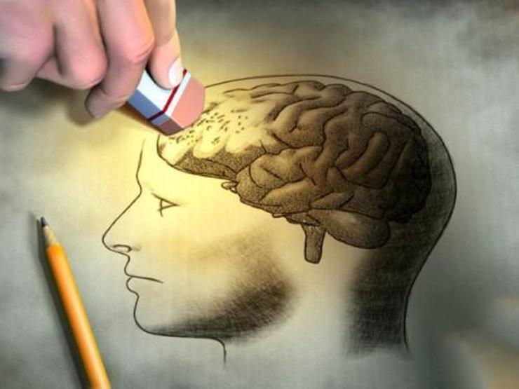 5 soruyla alzheimer testi