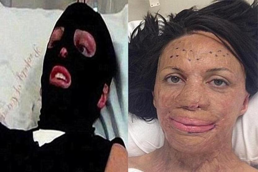 Turia Pitt ve sevgilisi Michael Hoskin nişanlandı