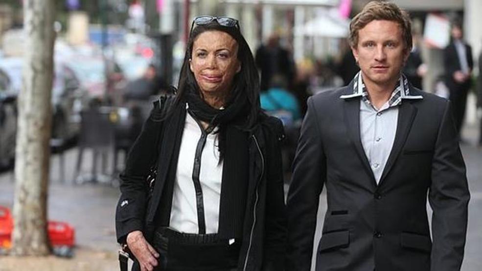 Turia Pitt ve sevgilisi Michael Hoskin nişanlandı