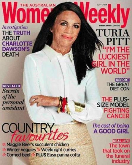 Turia Pitt ve sevgilisi Michael Hoskin nişanlandı