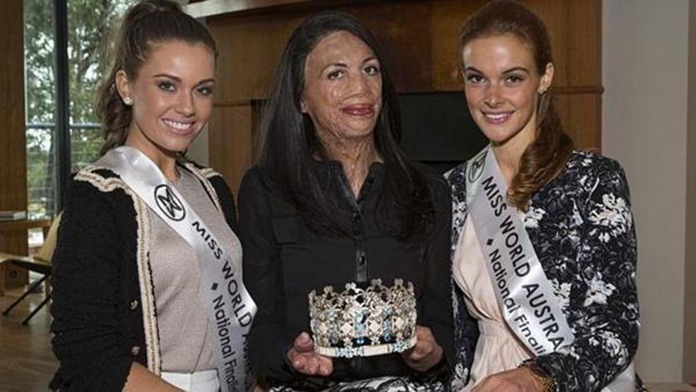Turia Pitt ve sevgilisi Michael Hoskin nişanlandı