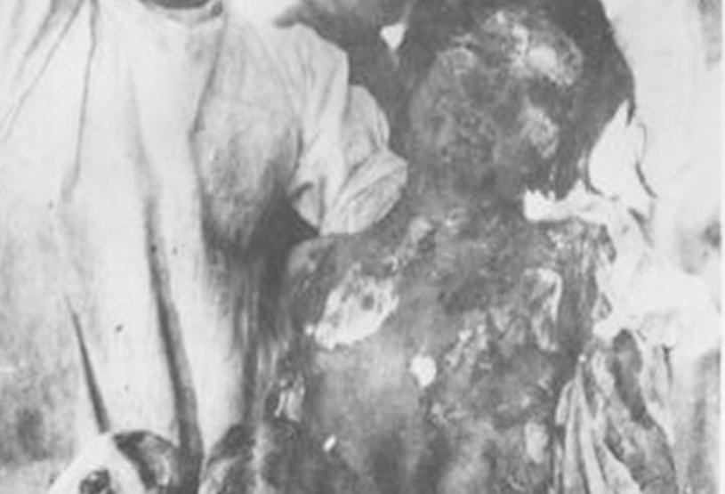 Hiroşima felaketinin 70. yılı