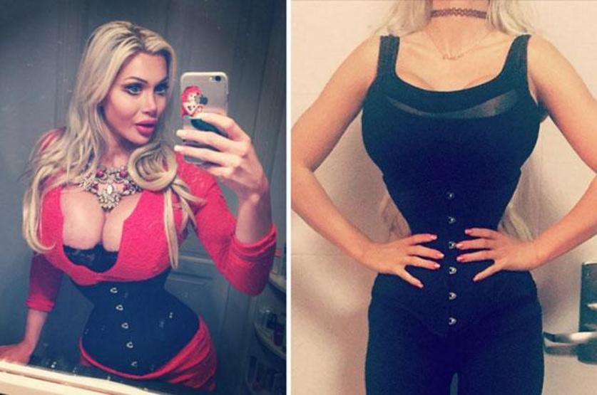 Jessica Rabbite benzemek için 15 estetik yaptırdı