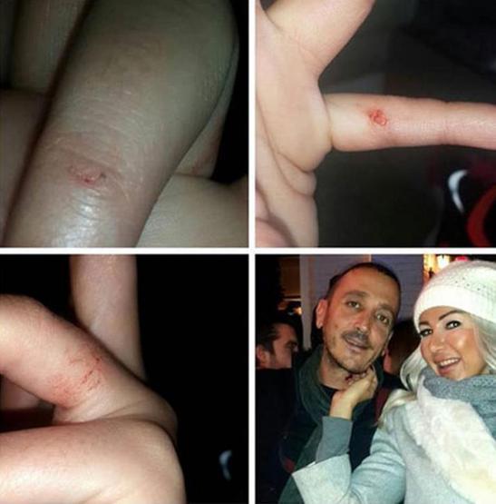 Doruk Haybat: Ben mi Nazlıya saldırırım yoksa o mu bana