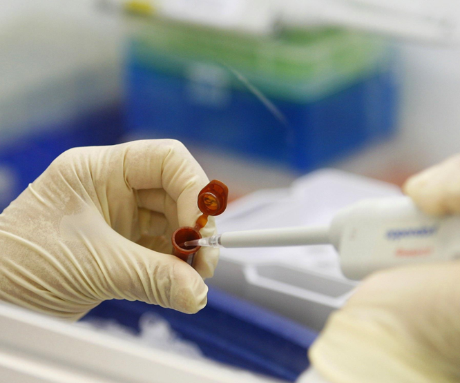 Zika virüsü ile ilgili sevindirici haber geldi