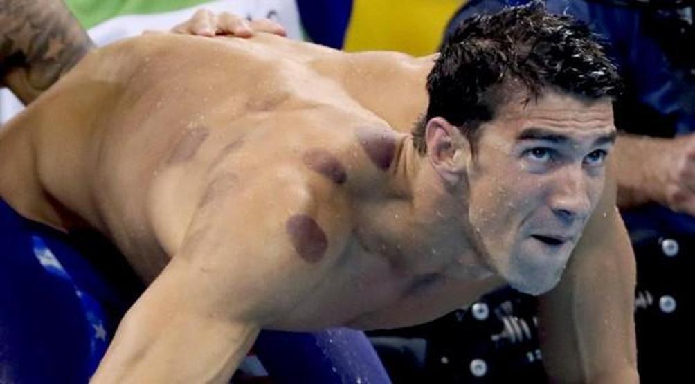 Michael Phelpse dev bir ahtapot saldırmamış