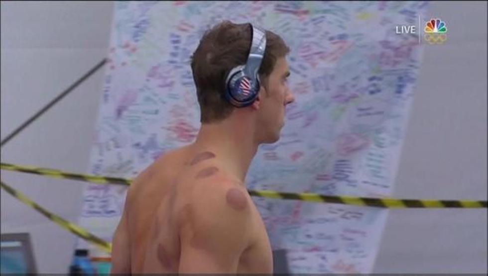 Michael Phelpse dev bir ahtapot saldırmamış
