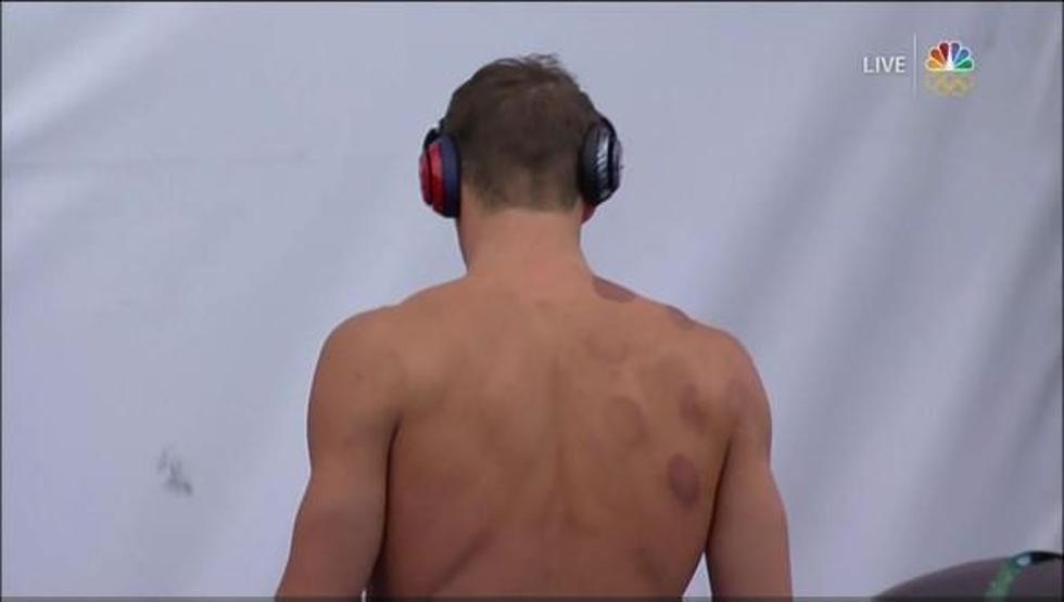 Michael Phelpse dev bir ahtapot saldırmamış