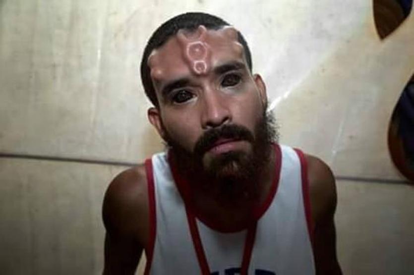 Film karakterine benzemek için akılalmaz ameliyatlar geçirdi