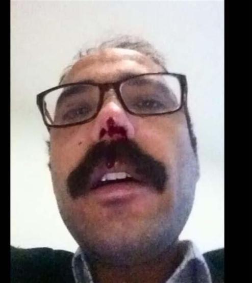 Avukattan adliyede darp iddiası
