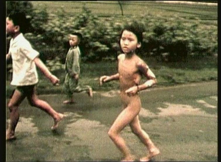 Vietnam Savaşının simgesi Kim Phuc İstanbulda