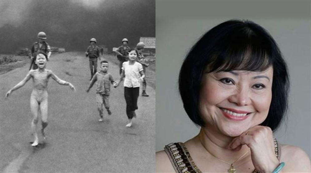 Vietnam Savaşının simgesi Kim Phuc İstanbulda