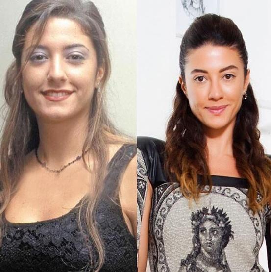 Başak Dizerin eski hali şaşırttı
