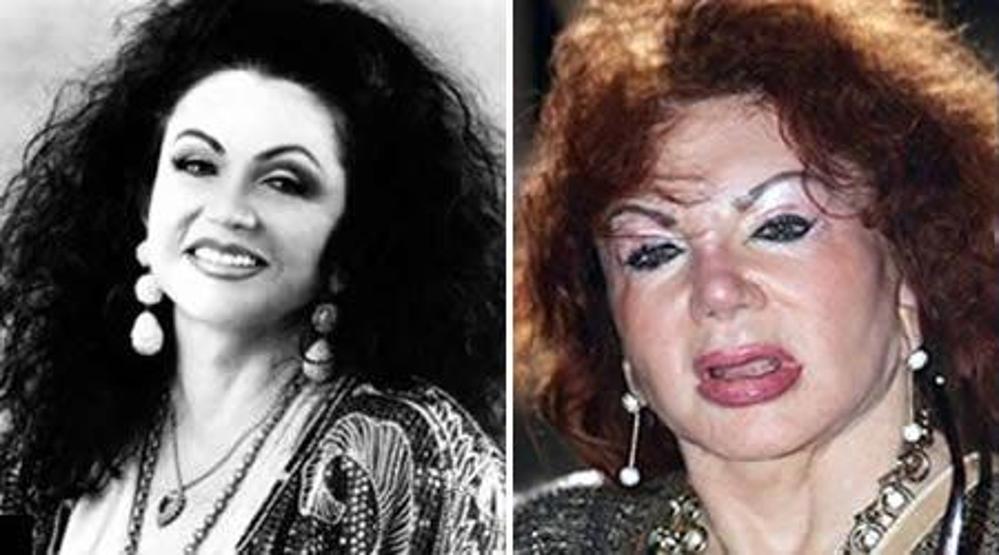 ‘Estetik’i çok yanlış anlayan 10 isim