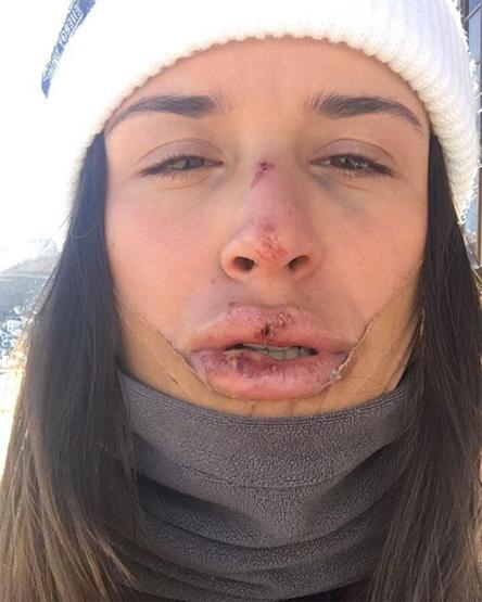 Klaudia Medlova suratının ne hale geldiğini paylaştı