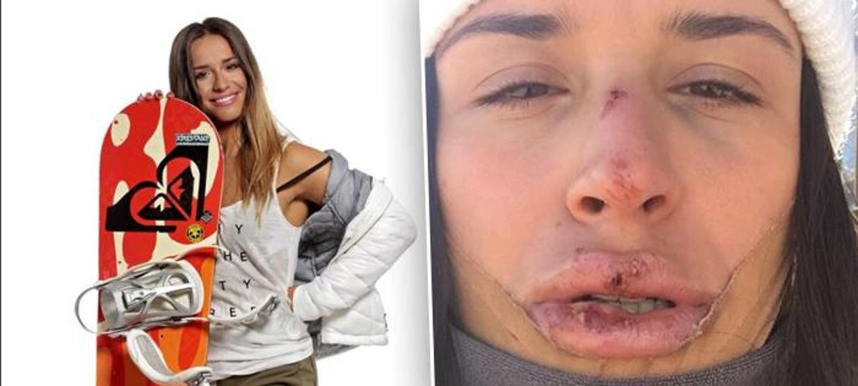 Klaudia Medlova suratının ne hale geldiğini paylaştı