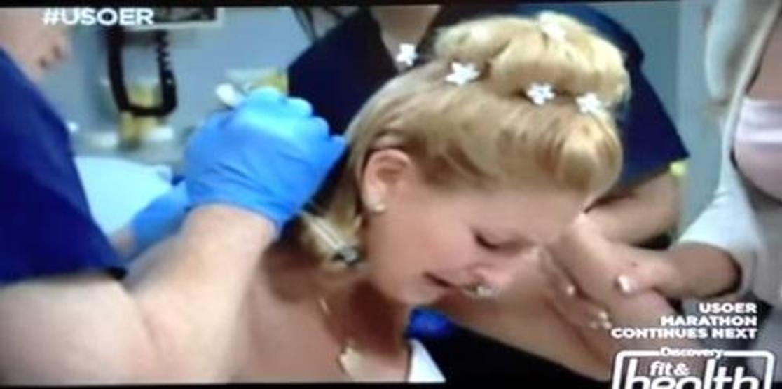 Tatilde sivrisinek ısırdı, düğün günü hayatının şokunu yaşadı