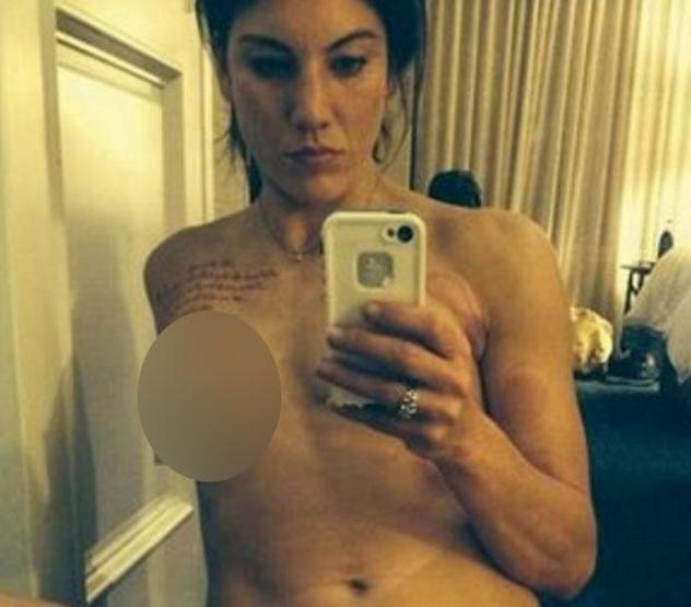 Hope Solo da hacker mağduru oldu