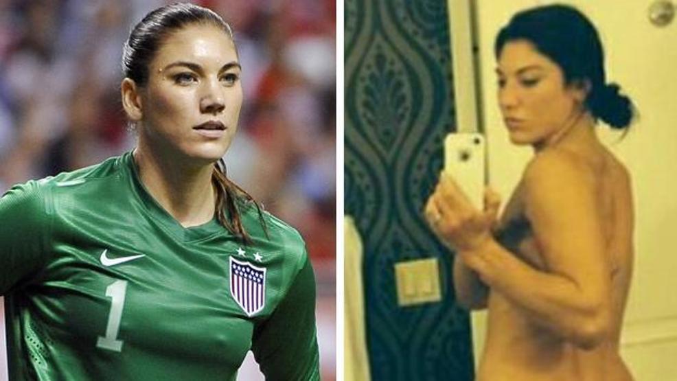 Hope Solo da hacker mağduru oldu