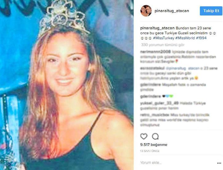Pınar Altuğ’un 23 yıl önceki estetiksiz hali şoke etti