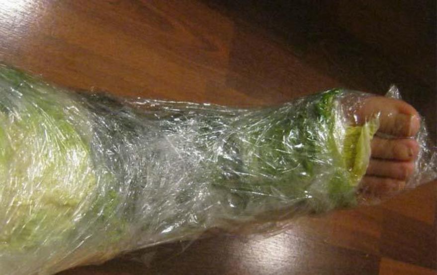 Eklem ağrısına lahanalı çözüm