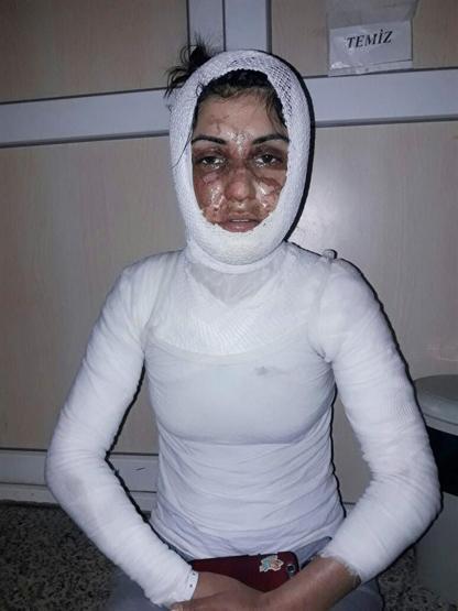 Kan donduran olay Uyuyan hala ve yeğenin üzerine asit döktüler