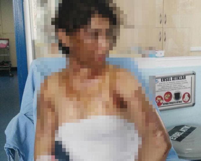 Kan donduran olay Uyuyan hala ve yeğenin üzerine asit döktüler