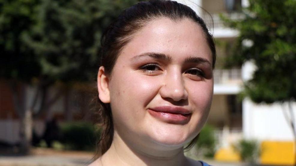 Merve Keleş’in dudakları dünya tıp literatürüne girebilir