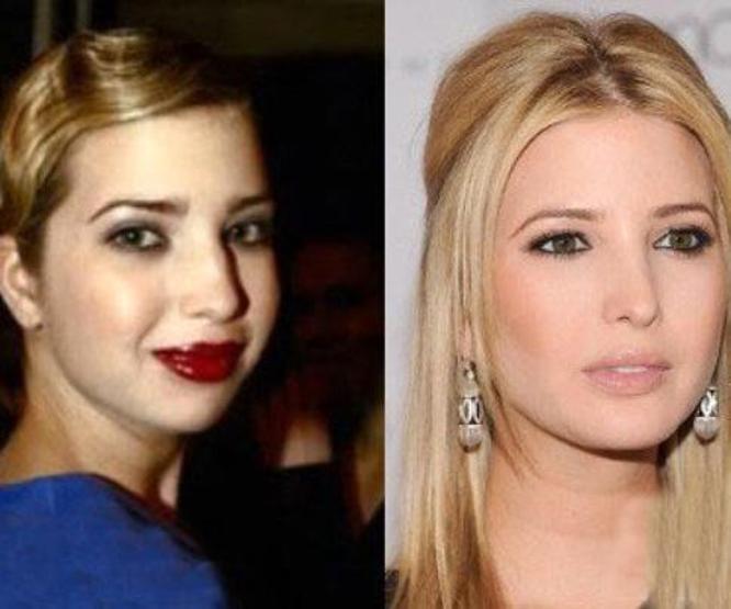 Ivanka Trumpın estetiksiz hali görenleri şaşırttı