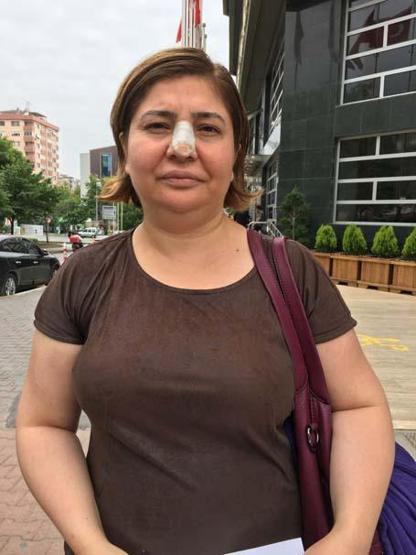 Kuafördeki kimyasal madde saçını yaktı
